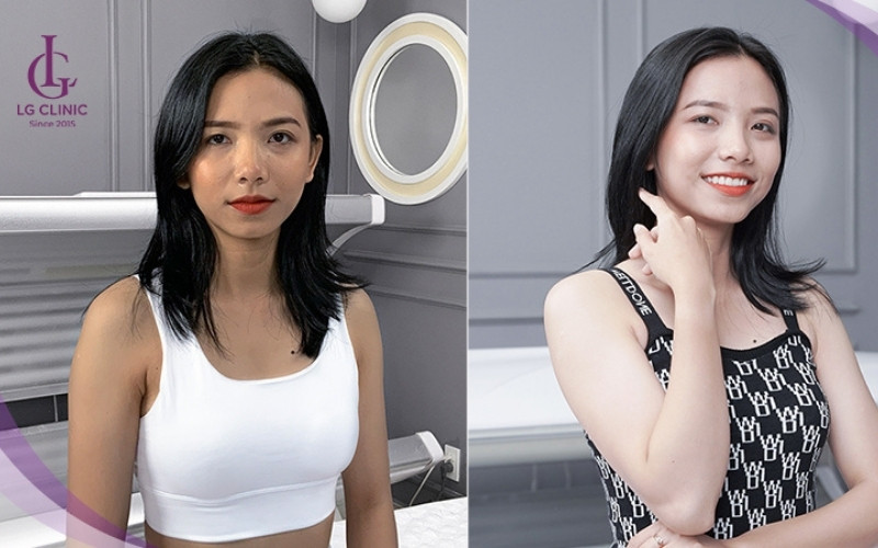 Hình ảnh khách hàng tắm trắng tại Quận Bình Thạnh