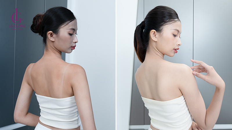 Khách hàng trước và sau khi thực hiện tắm trắng tại LG Clinic chi nhánh Gò Vấp