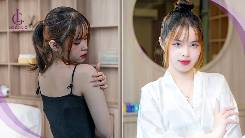 Sử dụng liệu trình tắm trắng tại spa có thể duy trì hiệu quả lâu hơn