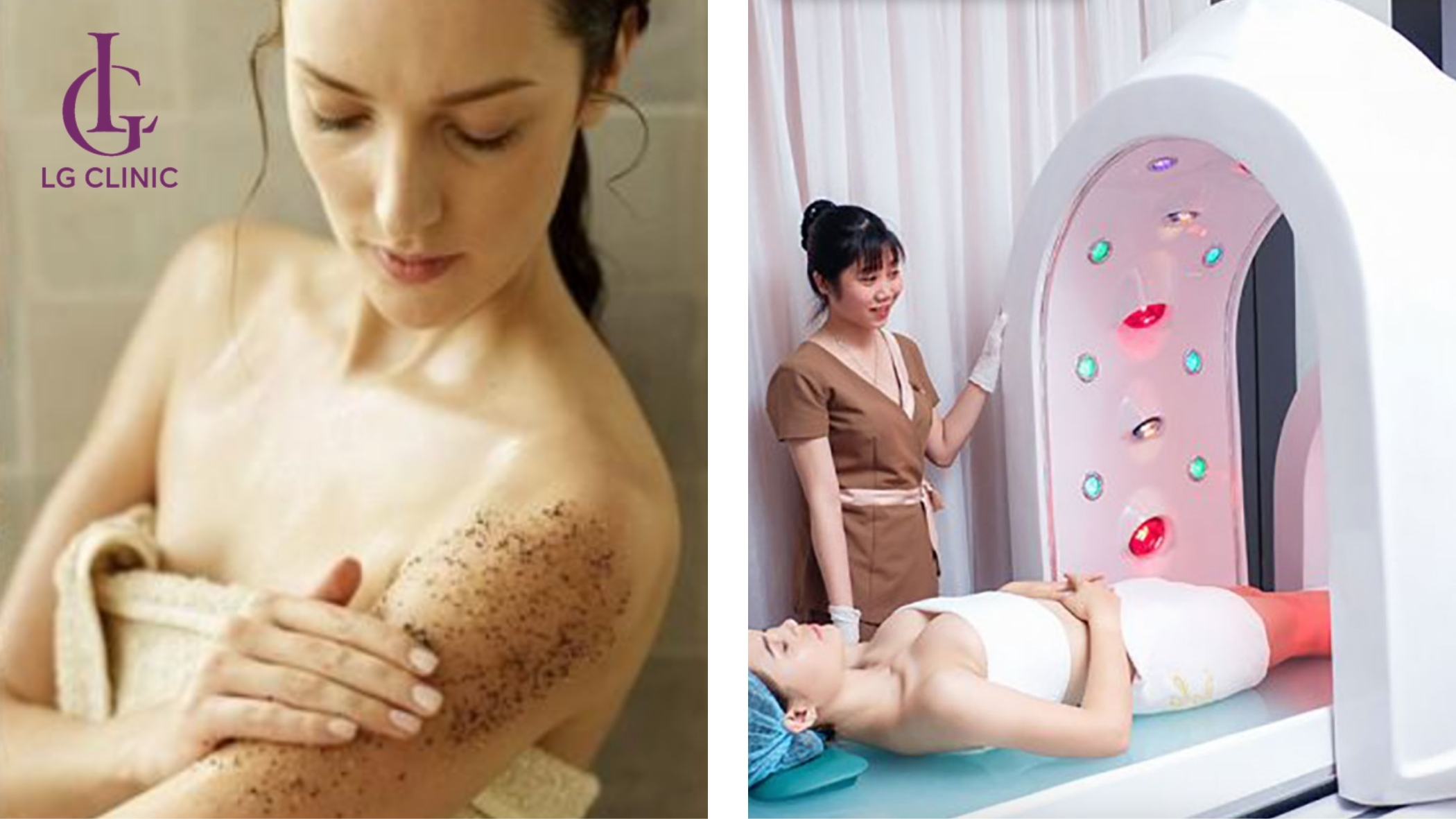 Phương pháp tắm trắng tại nhà và tắm trắng tại spa, thẩm mỹ viện