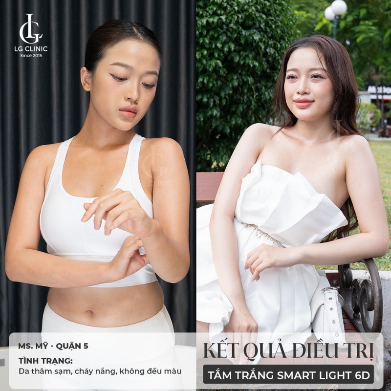Tắm trắng phi thuyền - tắm trắng phi thuyền giữ được bao lâu