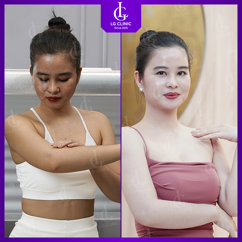 Tạm biệt thâm sạm với công nghệ tắm trắng phi thuyền hiện đại tại LG Clinic