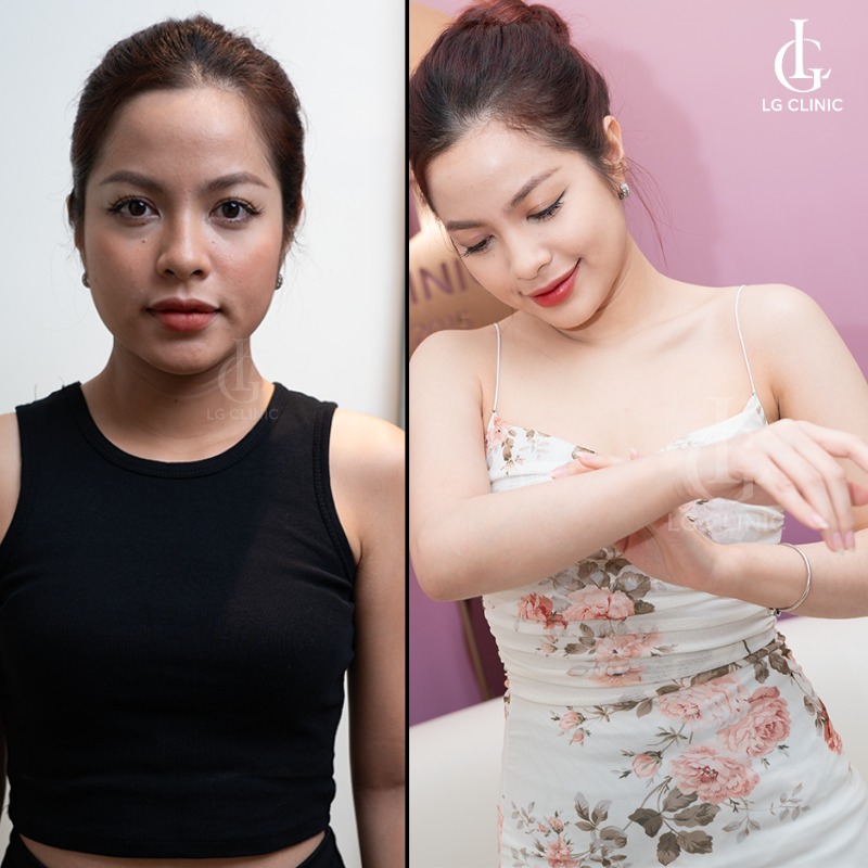 tắm trắng phi thuyền - tắm trắng phi thuyền giữ được bao lâu