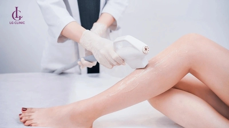 Triệt lông diode laser hiệu quả, an toàn cho mọi loại da