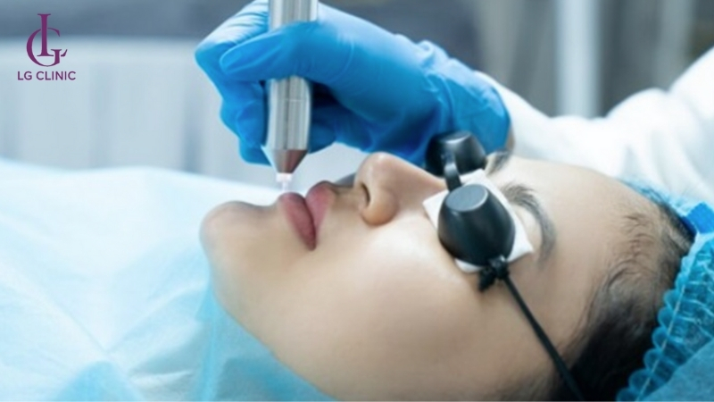 Xóa xăm môi bằng công nghệ Laser hiện đại, hiệu quả an toàn tại LG Clinic