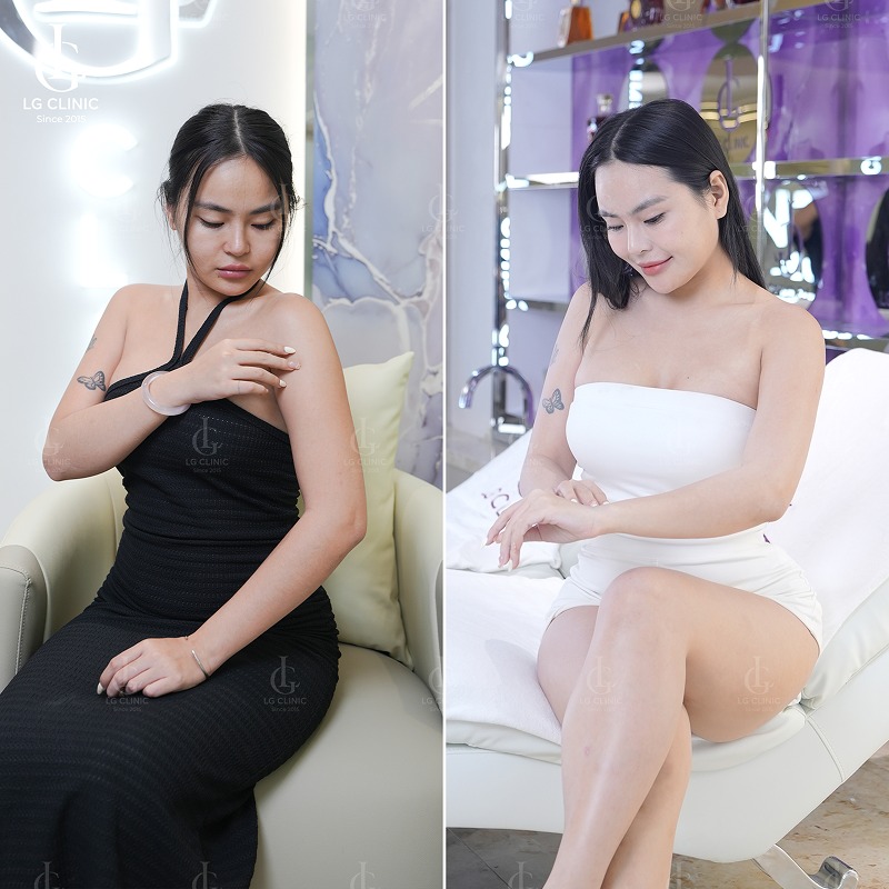 Cách làm chân trắng để mặc váy