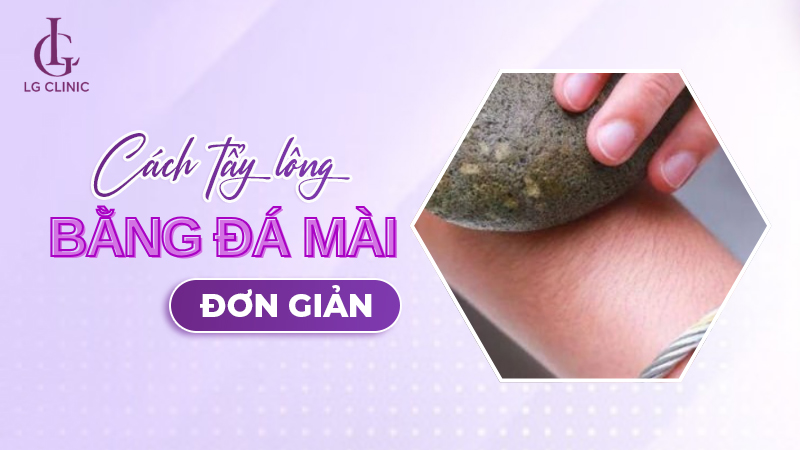 Cách tầy lông bằng đá mài