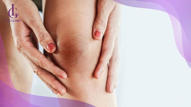 Có nhiều cách trị thâm đầu gối và khuỷu tay an toàn hiệu quả tại nhà