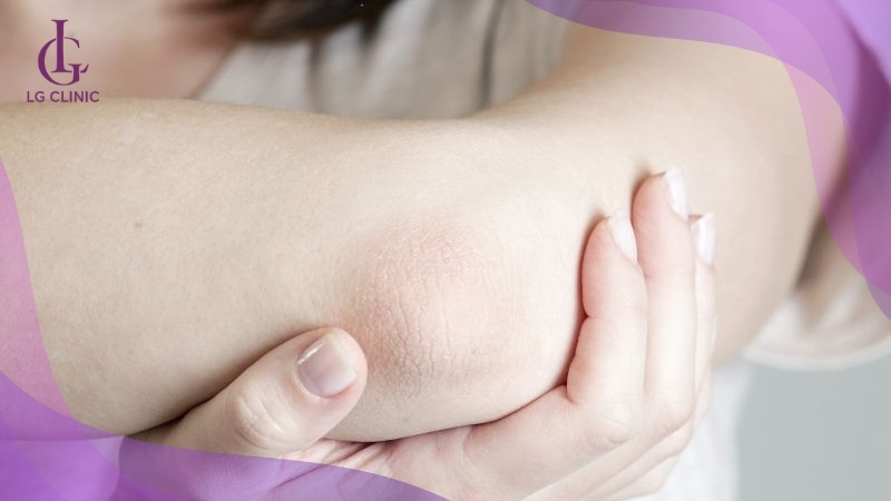 Dưỡng ẩm thường xuyên là chìa khóa để duy trì làn da sáng mịn
