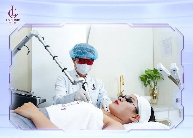 quy trình trị thâm bằng laser