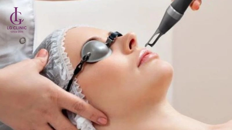 laser trị thâm hiệu quả với thâm sạm