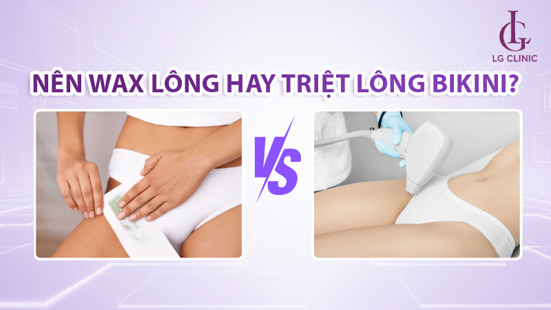 Nên wax lông hay triệt lông vùng kín