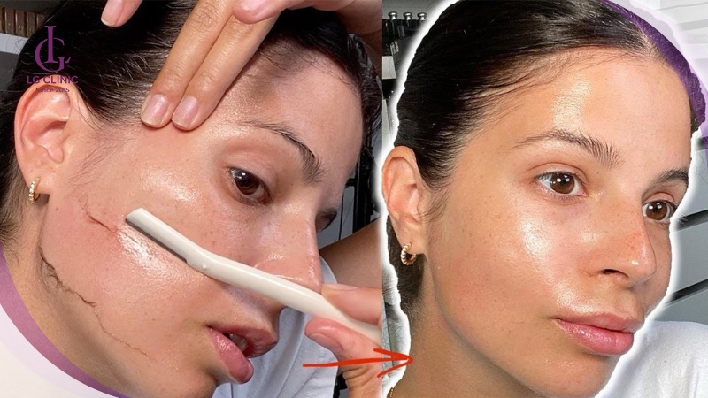 Cạo lông mặt đúng cách tại nhà giúp da sáng mịn