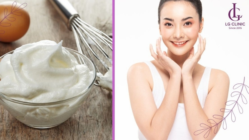 Cách triệt lông mặt vĩnh viễn tại nhà bằng trứng gà