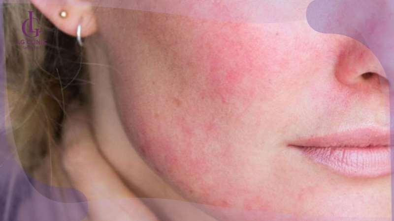 cách làm trắng da bằng chanh