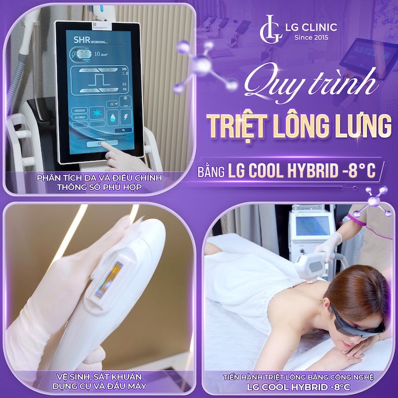 LG Clinic là địa chỉ triệt lông lưng uy tín