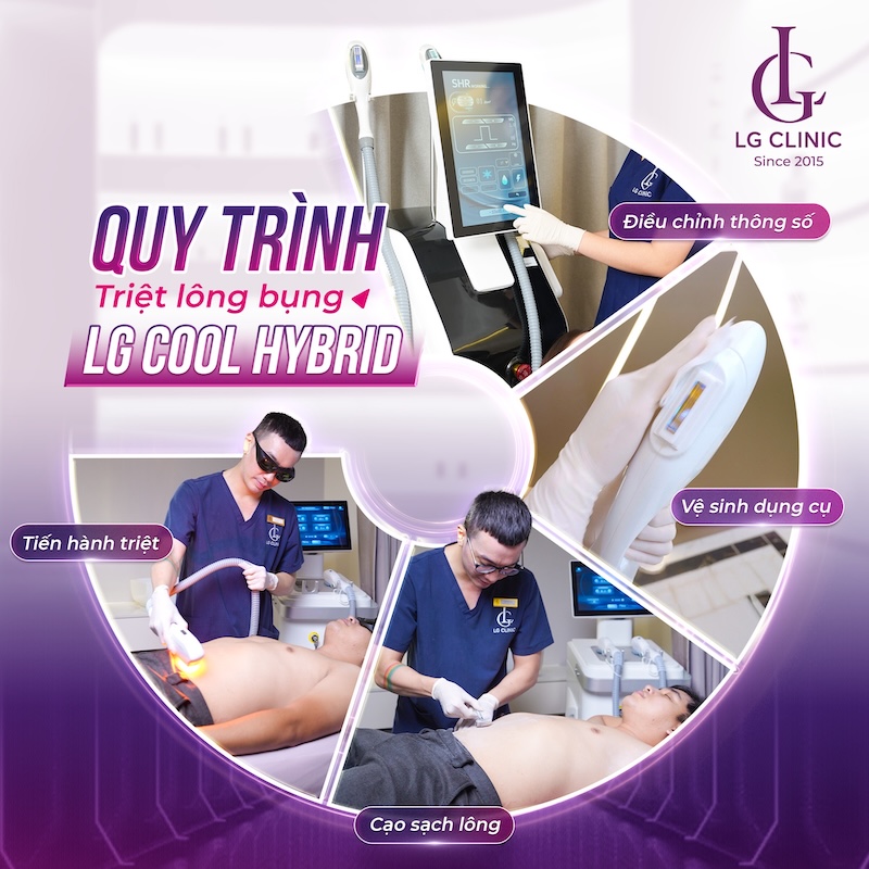 triệt lông bụng