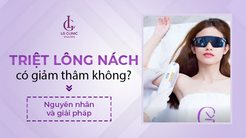 Triệt lông nách có hết thâm nách không