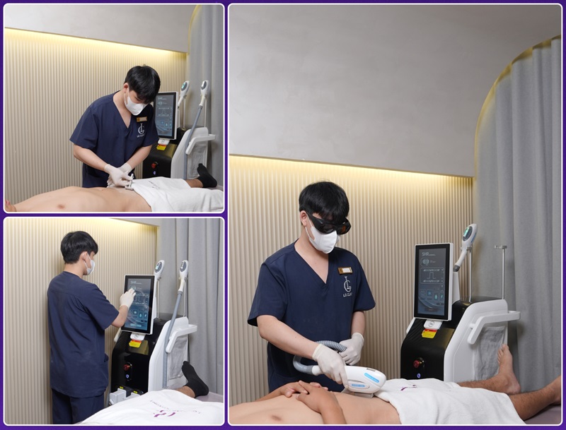 triệt lông vùng kín