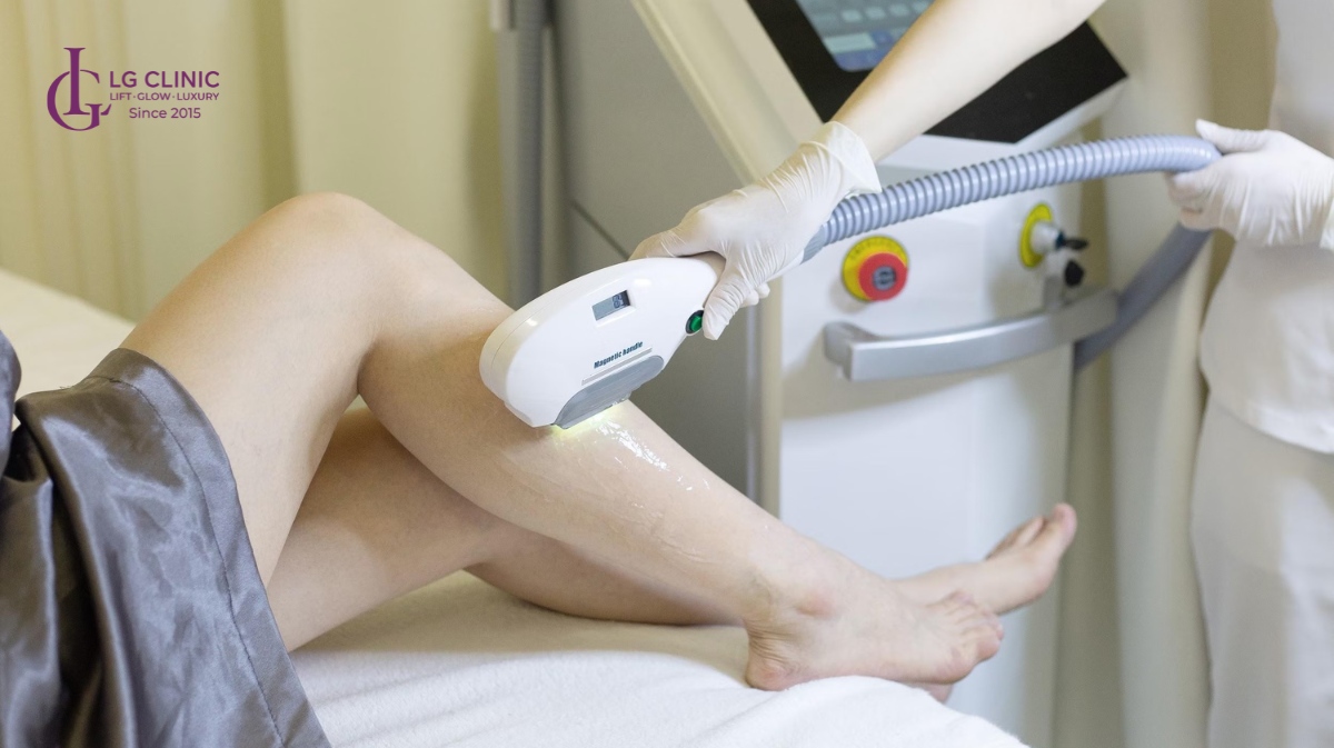 Công nghệ triệt lông IPL