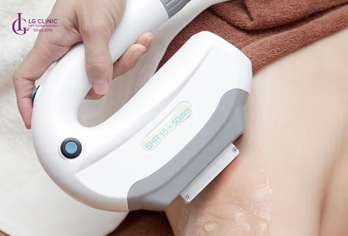 Công nghệ triệt lông OPT