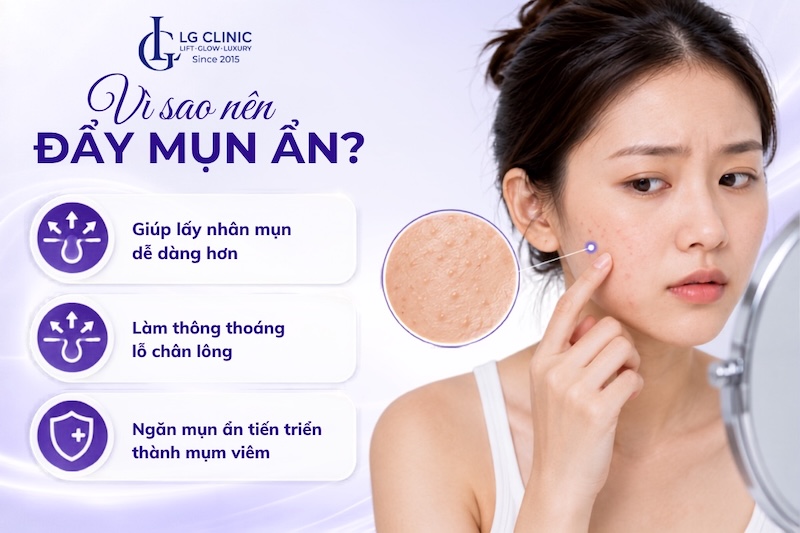 cách đẩy mụn ẩn