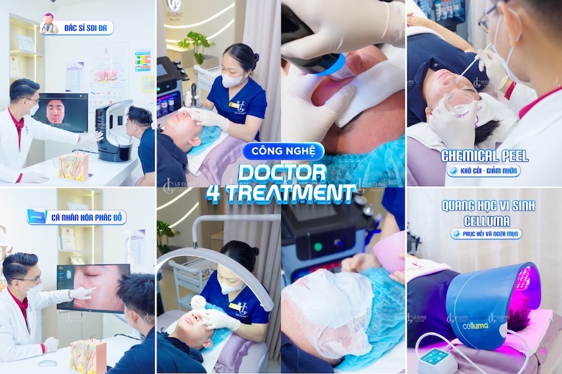 cách trị mụn cho nam giới tuổi dậy thì
