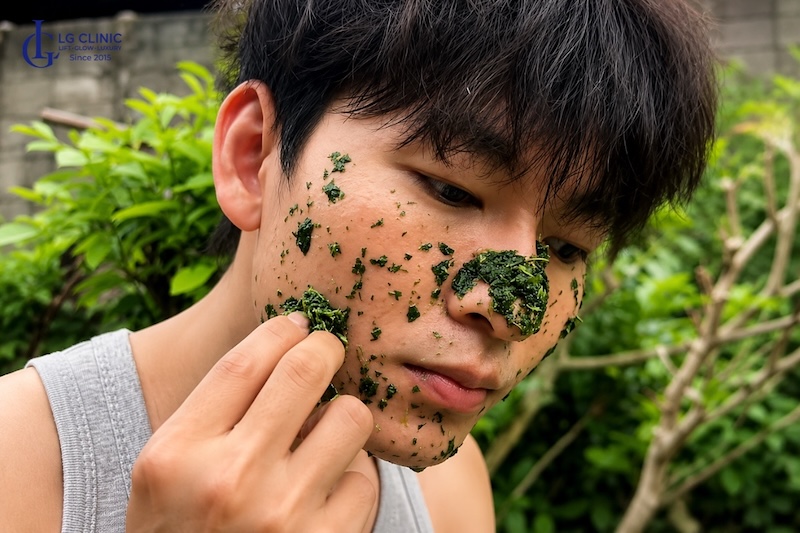 cách trị mụn cho nam tại nhà