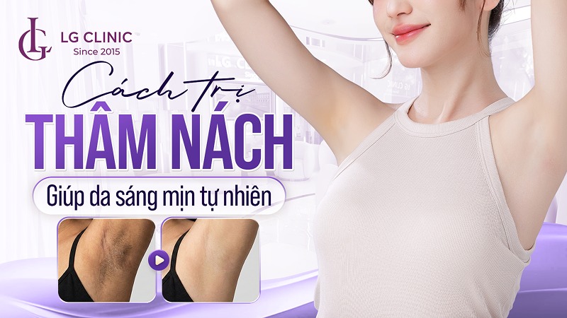 cách trị thâm nách