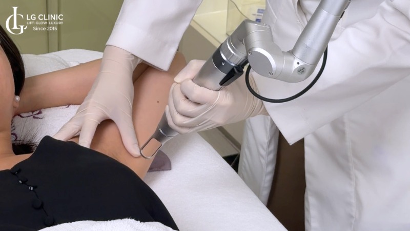 bảng giá trị thâm nách