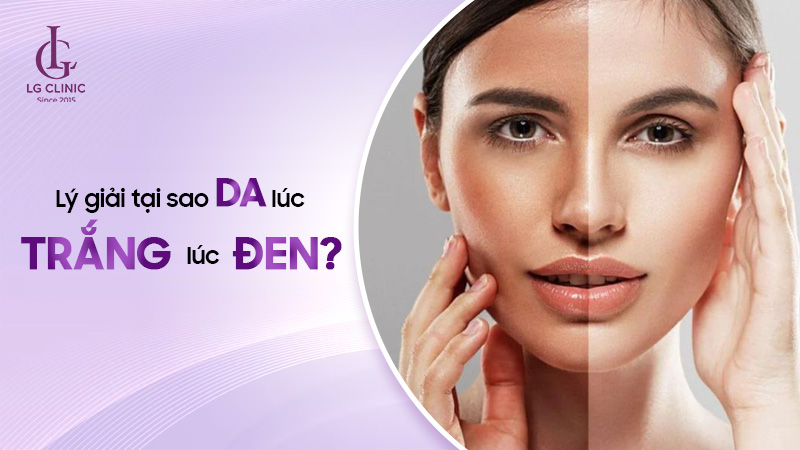 Tại sao da mặt lúc trắng lúc đen