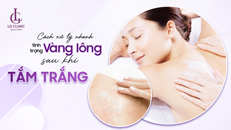 Tắm trắng bị vàng lông phải làm sao