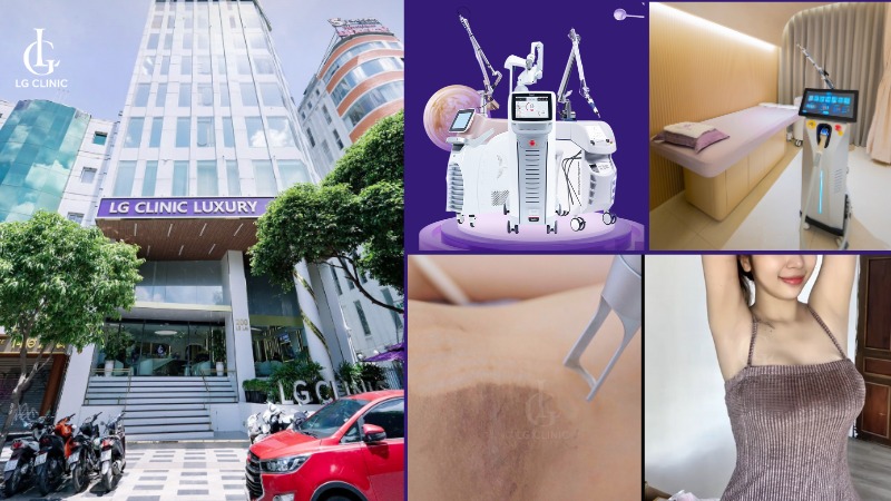 trị thâm nách - chữa thâm vùng nách