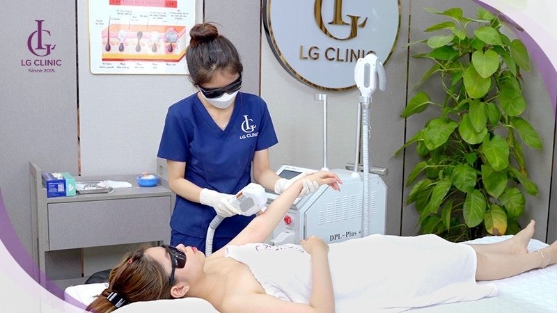 Triệt lông tay vĩnh viễn là gì và có hiệu quả ra sao?
