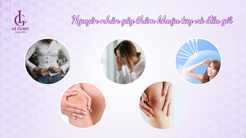 Nguyên nhân gây thâm khuỷu tay và đầu gối