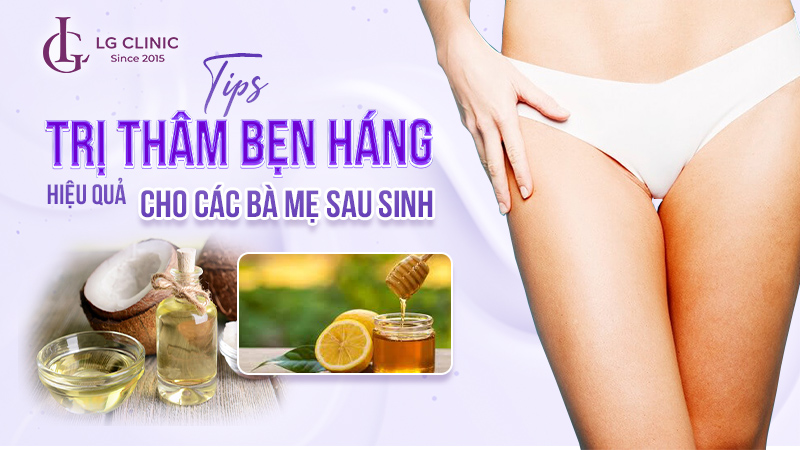 Cách trị thâm bẹn háng sau sinh