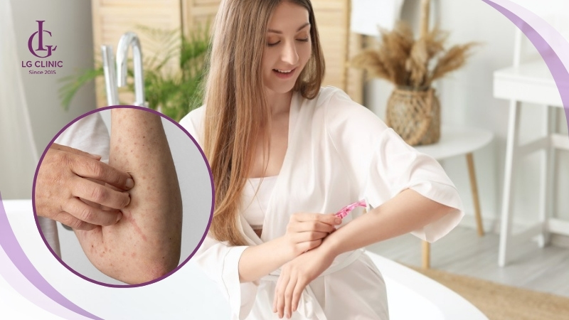 Cạo lông tay sai cách gây viêm nang lông