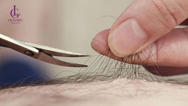 cạo lông vùng kín nam bằng kéo