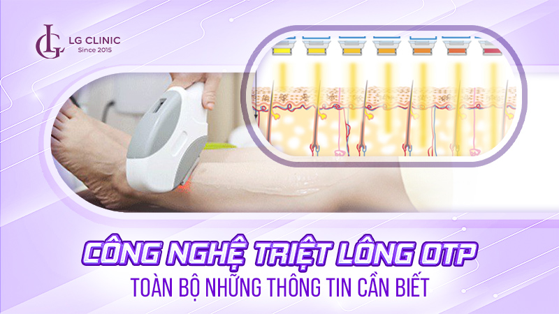 Công nghệ triệt lông OPT