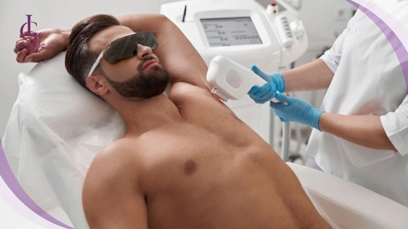 Triệt lông bằng công nghệ diode laser hiệu quả cho mọi loại da và giới tính