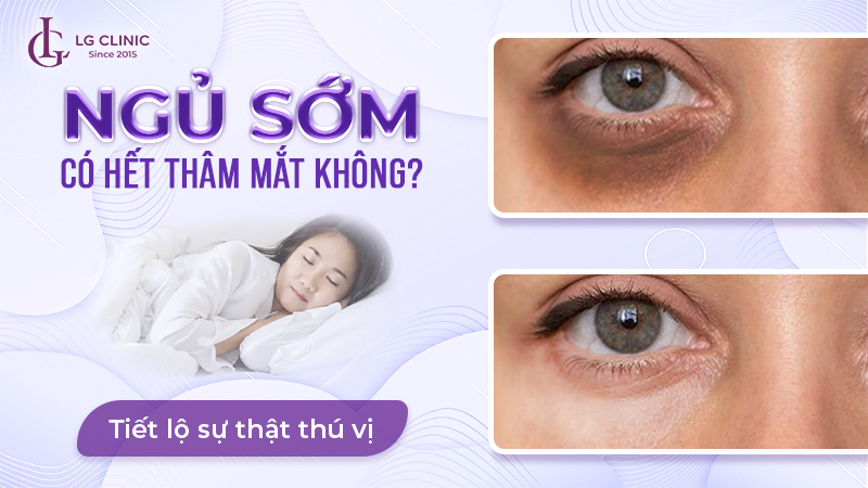 Ngủ sớm có hết thâm mắt không