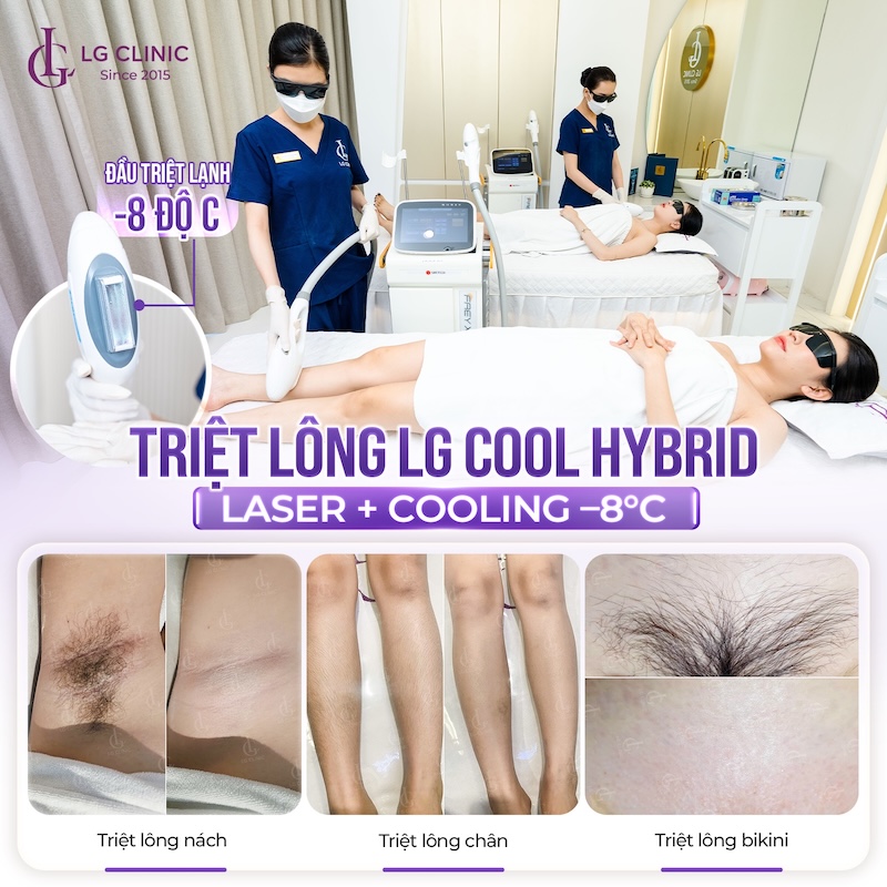 triệt lông lạnh