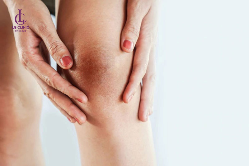 Con gái bị thâm đầu gối