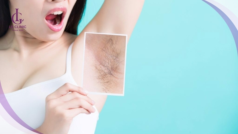 Sự hình thành của lông nách