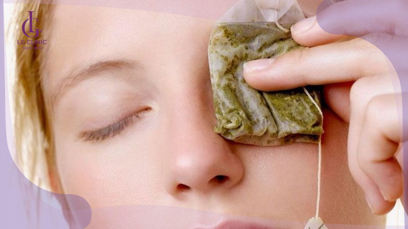 Đắp túi trà giảm thâm mắt