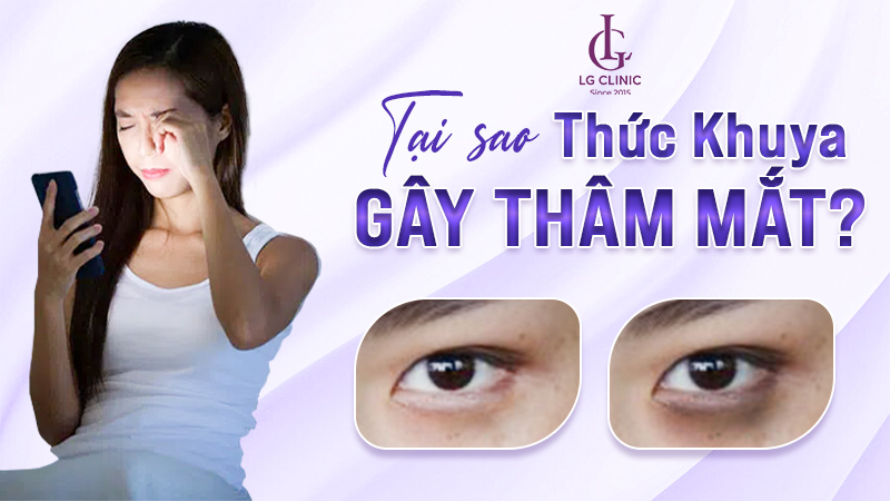 Thức khuya mắt thâm