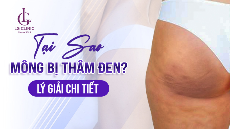 trị thâm mông - trị mông thâm đen