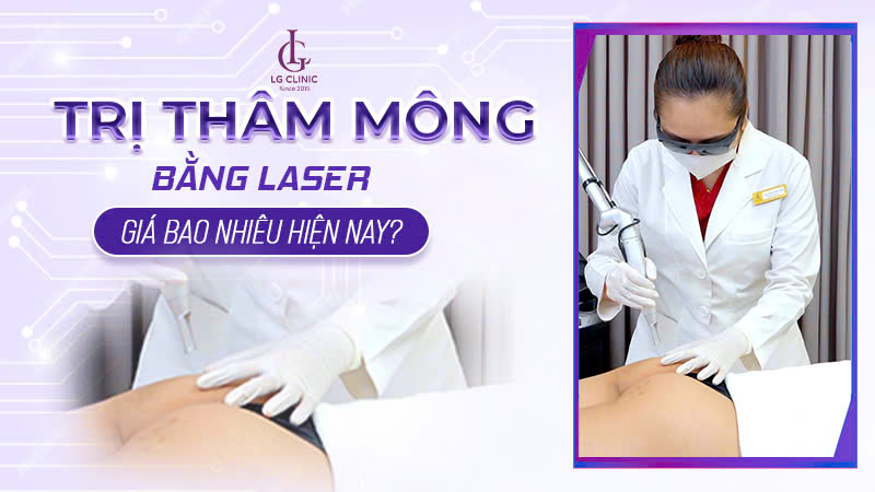 Trị thâm mông bằng laser giá bao nhiêu