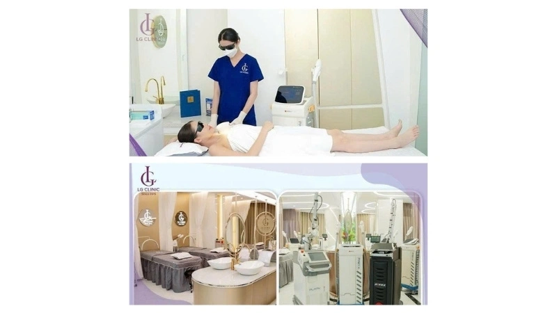 LG Clinic triệt lông bằng công nghệ diode laser uy tín hiệu quả cao