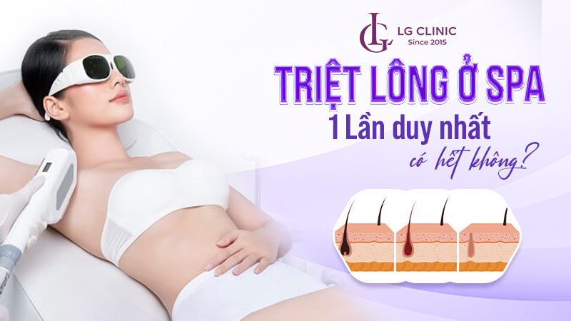 Triệt lông ở spa 1 lần có hết không